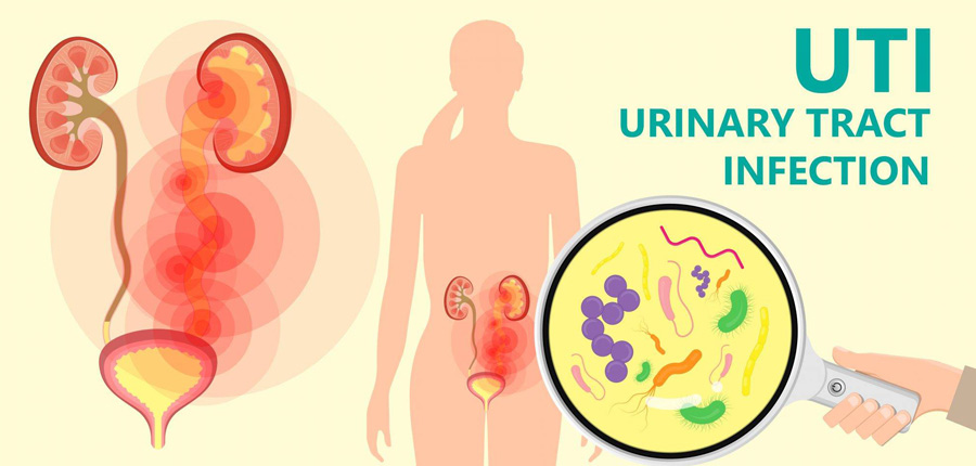 Urinary Tract Infection Treatment in Siliguri